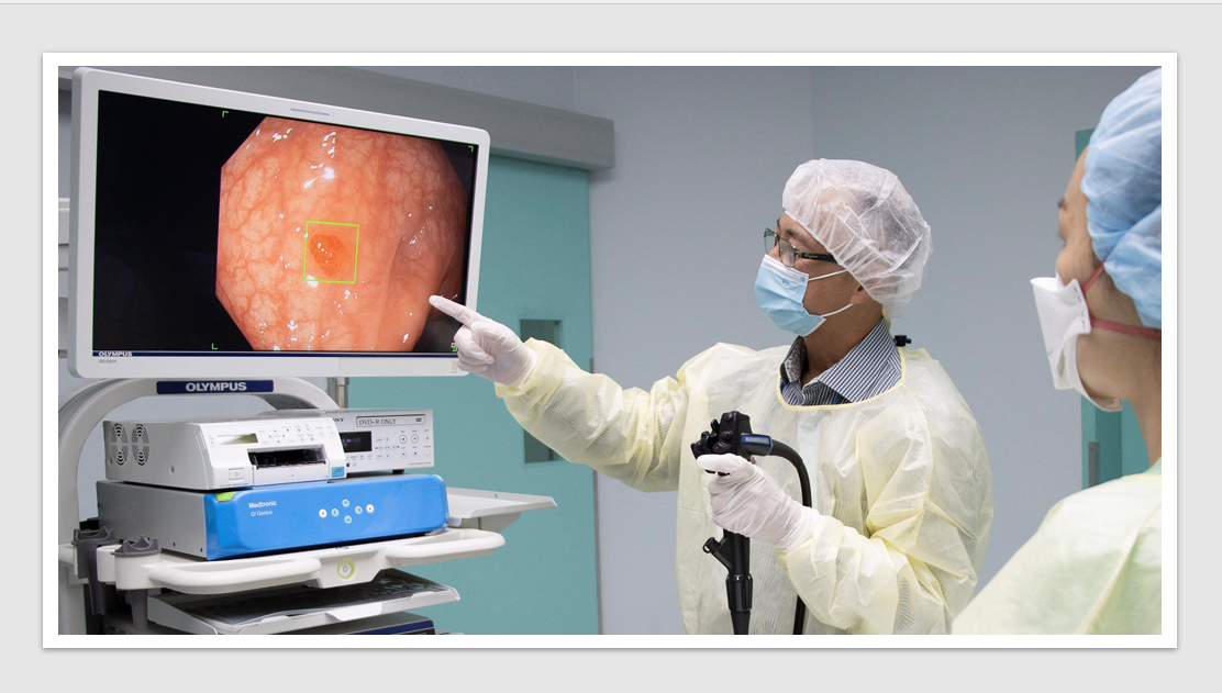 AI-assisted colonoscopy boosts polyp and adenoma detection